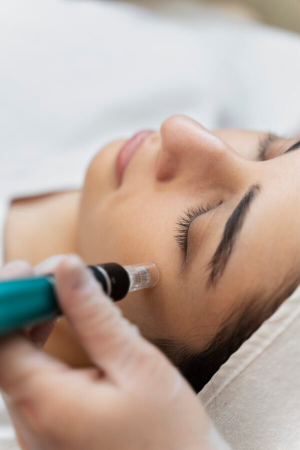 person-getting-micro-needling-beauty-treatment Kasvohoito 70 min lahjakortti